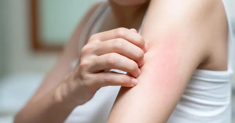 擦了乳液還是皮膚癢？醫推「這時間」是黃金潤膚期保濕力加倍