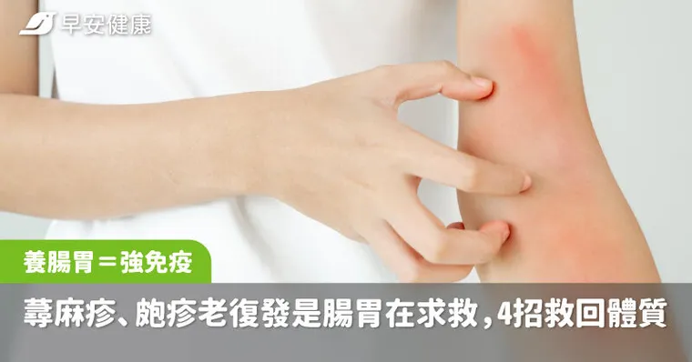 養腸胃＝強免疫！蕁麻疹、皰疹老是復發其實是腸胃在求救，4招救回好體質