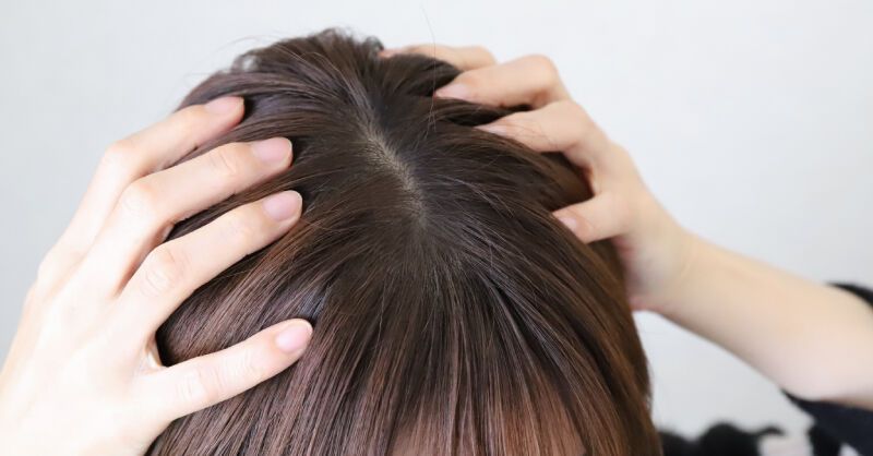 髮量越來越少？4種「掉髮體質」髮線後退、鬼剃頭這方法救回來