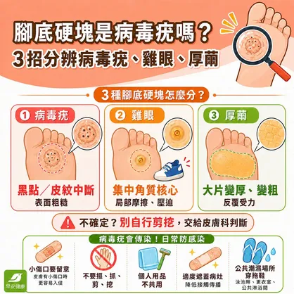 病毒疣會傳染嗎？初期辨識、冷凍治療與防復發完整指南