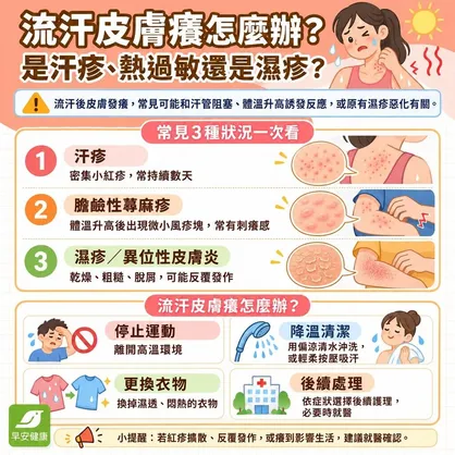 流汗皮膚癢怎麼辦？擦什麼藥？汗疹蕁麻疹快篩、藥膏與防癢指南