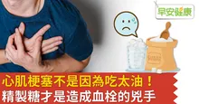 心肌梗塞不是因為吃太油！精製糖才是造成血栓的兇手