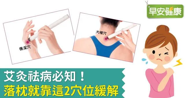 艾灸祛病必知！落枕就靠這2穴位緩解