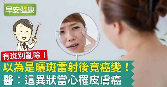 以為是曬斑雷射後竟癌變！醫：這異狀當心罹皮膚癌