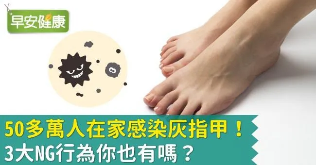 灰指甲如何預防與治療？50萬人感染灰指甲有三大壞習慣