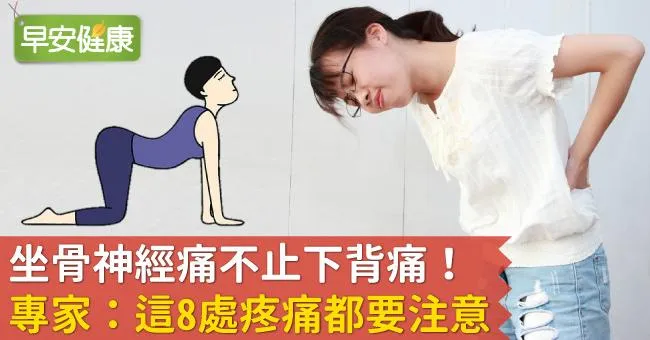 坐骨神經痛不止下背痛！專家：這8處疼痛都要注意