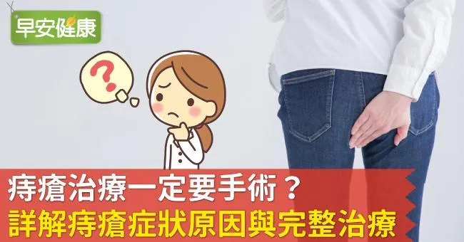痔瘡治療除了手術，還推薦哪些方法？詳解痔瘡症狀原因與完整治療