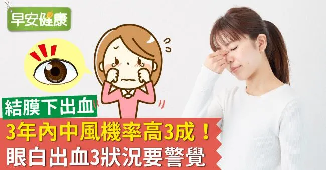 結膜下出血3年內中風機率高3成！眼白出血3狀況要警覺