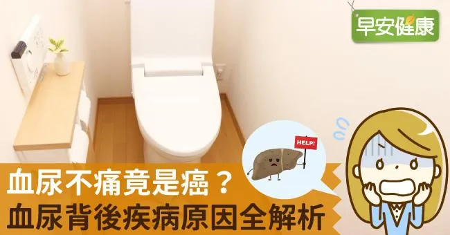 血尿不痛竟是癌？血尿背後疾病原因全解析