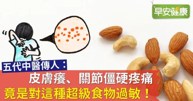 皮膚癢、關節僵硬疼痛，竟是對這種超級食物過敏！