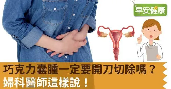 巧克力囊腫一定要開刀切除嗎？醫師解析巧克力囊腫治療