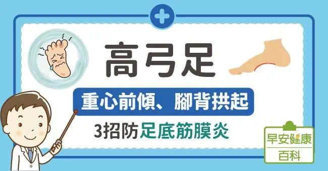 高弓足：重心前傾、腳背拱起，3招防足底筋膜炎