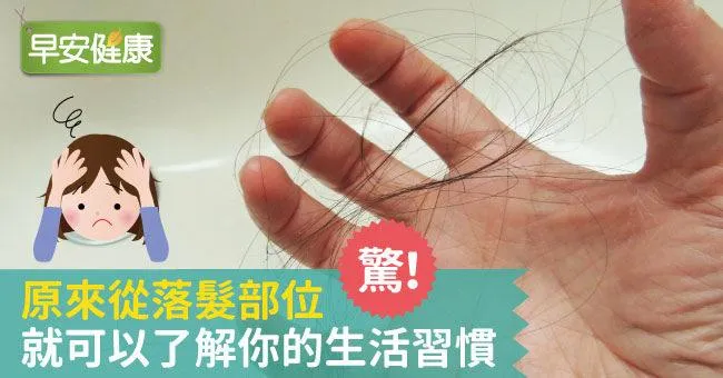 驚！原來從落髮部位就可以了解你的生活習慣