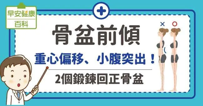 骨盆前傾：重心偏移、小腹突出！2個鍛鍊回正骨盆