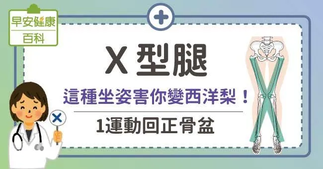 X型腿讓身材走樣、身體痠痛！1運動改善X型腿