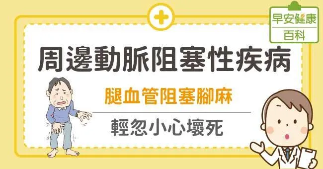 周邊動脈阻塞性疾病：腳麻、跛行...忽視腳趾恐潰瘍壞死