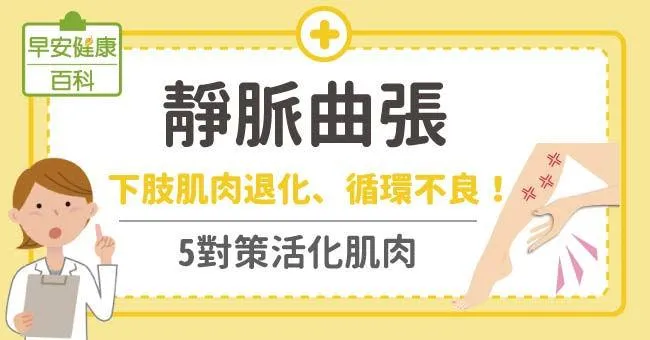 造成靜脈曲張的原因為何？如何預防與治療？