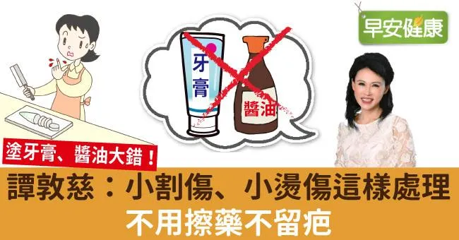 譚敦慈：小割傷、小燙傷這樣處理，不用擦藥不留疤