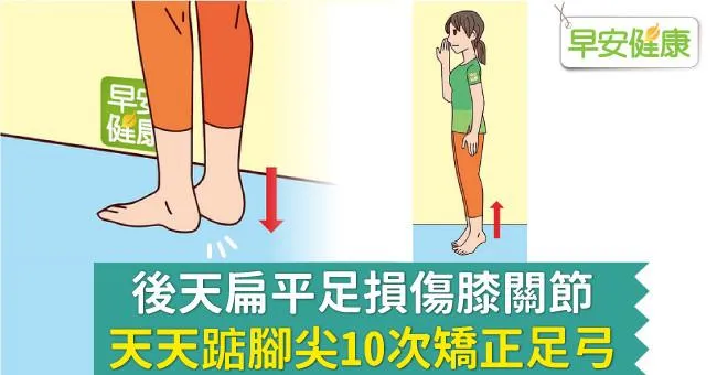 後天扁平足損傷膝關節，天天踮腳尖10次矯正足弓