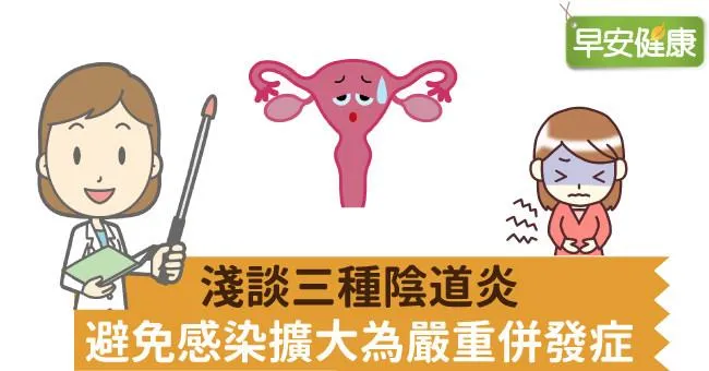 淺談三種陰道炎，避免感染擴大為嚴重併發症