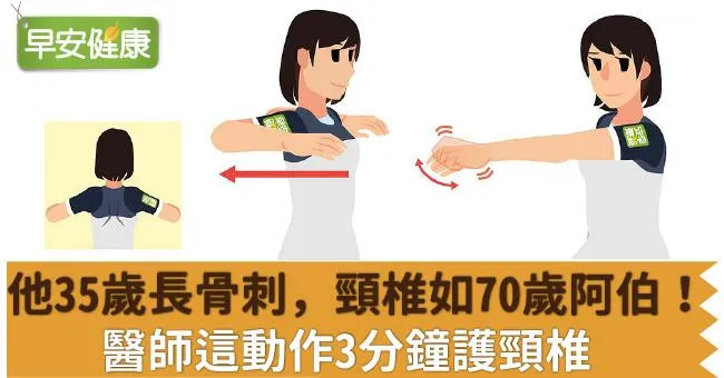 他35歲長骨刺，頸椎如70歲阿伯！醫師這動作3分鐘護頸椎