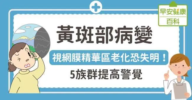 黃斑部病變：視網膜精華區老化恐失明！5族群提高警覺