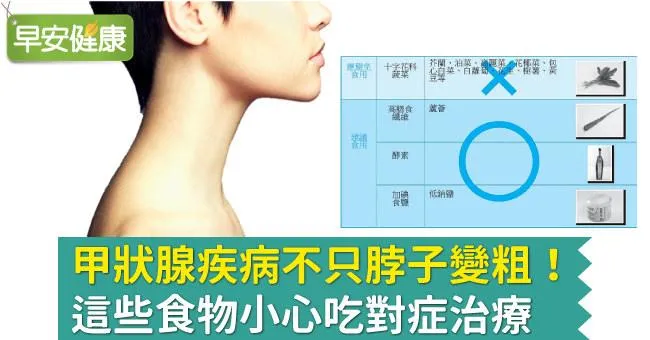 甲狀腺疾病不只脖子變粗！這些食物小心吃對症治療