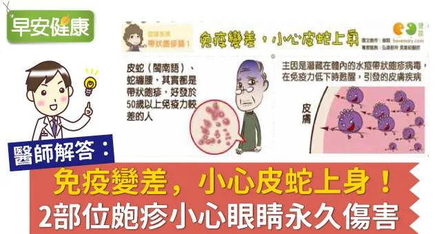 免疫變差，小心皮蛇上身！2部位皰疹小心眼睛永久傷害