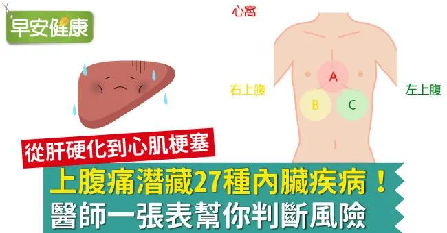 上腹痛潛藏27種內臟疾病！醫師一張表幫你判斷風險