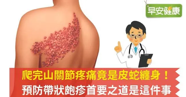 爬完山關節疼痛竟是皮蛇纏身！預防帶狀皰疹首要之道是這件事