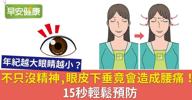 不只沒精神，眼皮下垂竟會造成腰痛！15秒輕鬆預防