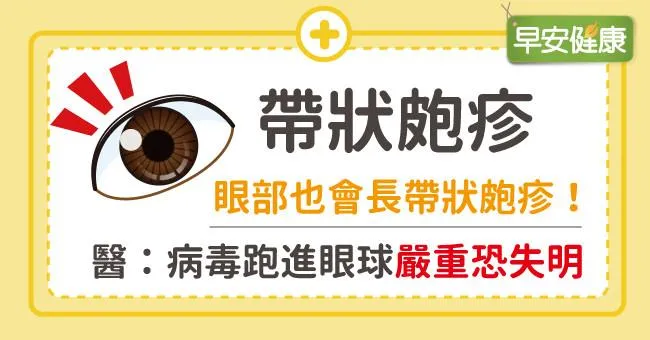 眼部也會長帶狀皰疹！醫：病毒跑進眼球嚴重恐失明