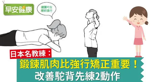 鍛鍊肌肉比強行矯正重要！改善駝背先練2動作