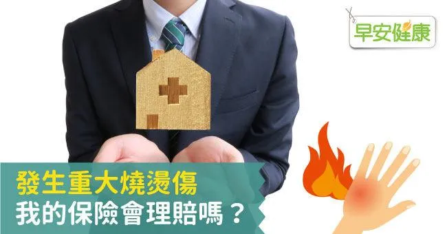 發生重大燒燙傷，我的保險會理賠嗎？