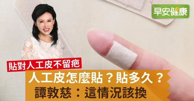人工皮怎麼貼？貼多久？譚敦慈：這情況該換