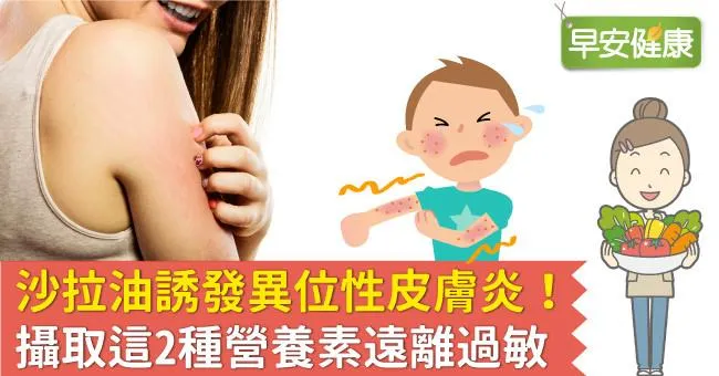 沙拉油誘發異位性皮膚炎！攝取這2種營養素遠離過敏