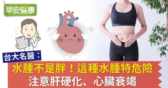 水腫不是胖！這種水腫特危險，注意肝硬化、心臟衰竭