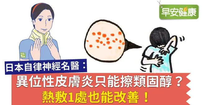 異位性皮膚炎只能擦類固醇？熱敷1處也能改善！