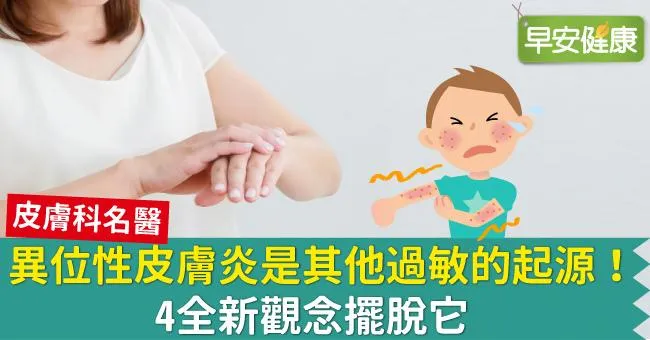 異位性皮膚炎是其他過敏的起源！4全新觀念擺脫它