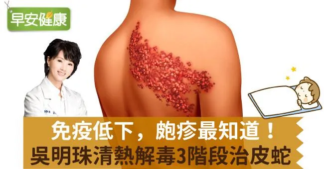 免疫低下，皰疹最知道！吳明珠清熱解毒3階段治皮蛇