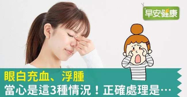 眼白充血、浮腫，當心是這3種情況！正確處理是…