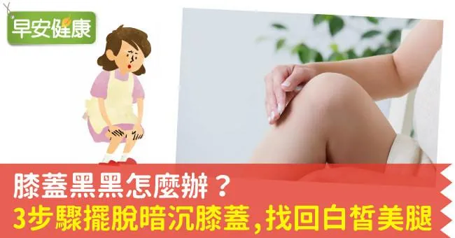 膝蓋黑黑怎麼辦？3步驟擺脫暗沉膝蓋，找回白皙美腿！