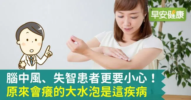腦中風、失智患者更要小心！原來會癢的大水泡是這疾病