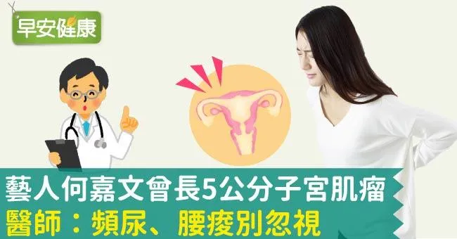 藝人何嘉文曾長5公分子宮肌瘤！醫師：頻尿、腰痠別忽視