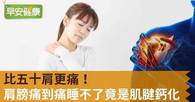 比五十肩更痛！肩膀痛到痛睡不了竟是肌腱鈣化