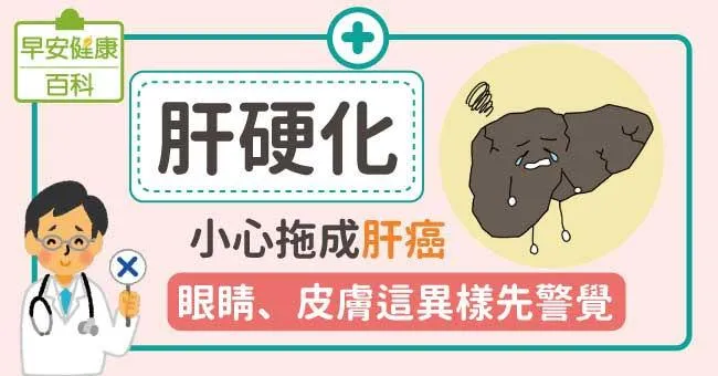 肝硬化變肝癌！警覺肝硬化14種症狀，肝硬化飲食原則