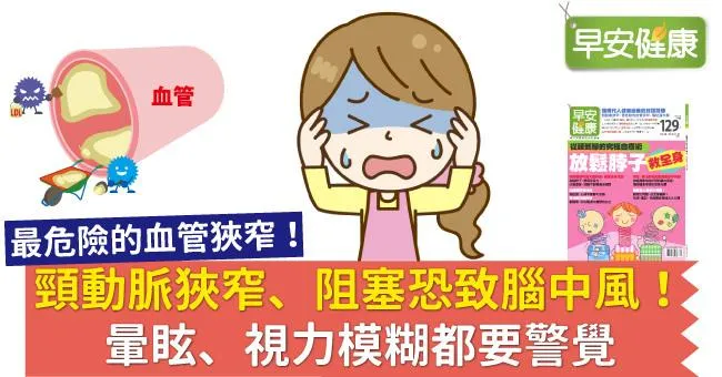 頸動脈狹窄、阻塞恐致腦中風！暈眩、視力模糊都要警覺