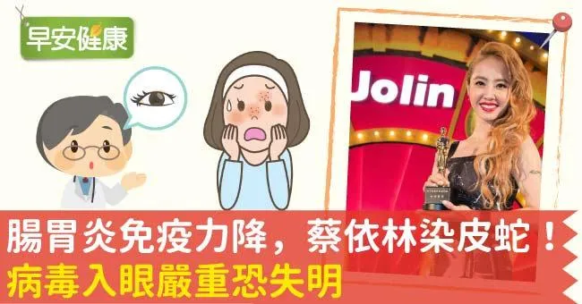 腸胃炎免疫力降，蔡依林染皮蛇！病毒入眼嚴重恐失明