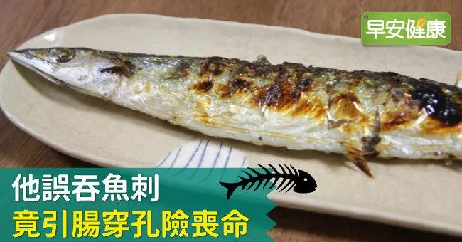 他誤吞魚刺　竟引腸穿孔險喪命