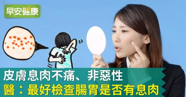 皮膚息肉不痛、非惡性，醫：最好檢查腸胃是否有息肉
